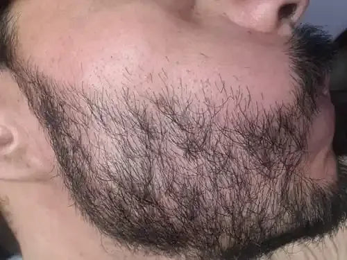 2x1-apolo-b-lsamo-activador-de-barba-con-20-de-minoxidil resena_foto_7